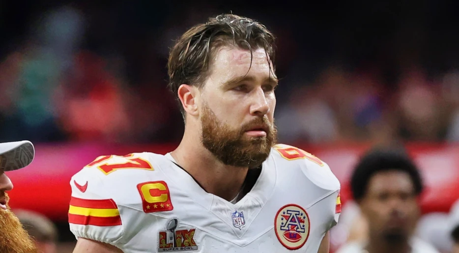 Hair Loss Specialist Reveals The Truth About Travis Kelce’s Hair Transplant Rumors After Everyone Noticed Something Fishy During Super Bowl