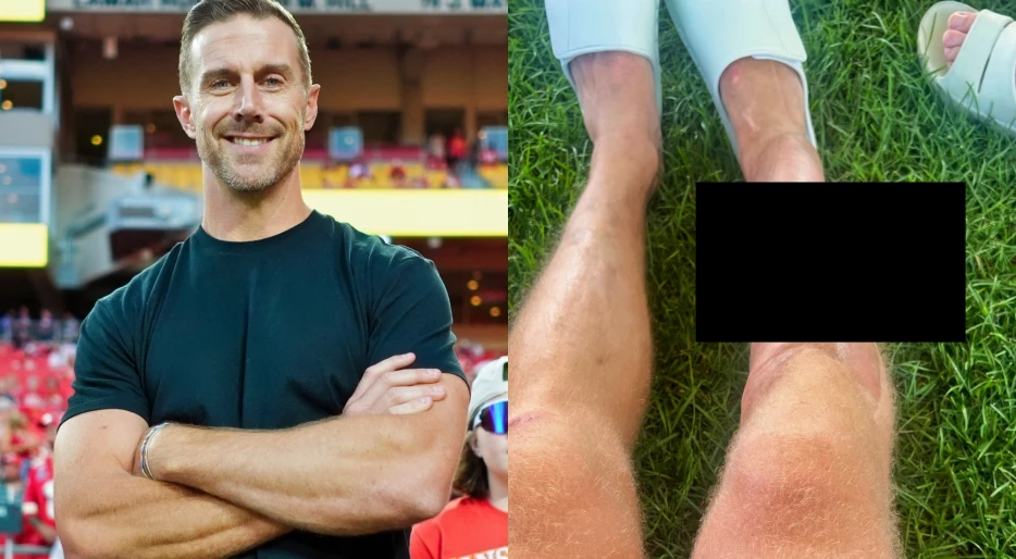 “He Made The Playoffs On That Leg”: NFL Fans Stunned By New Viral Photo Of Alex Smith’s Shocking Post-Surgery Leg