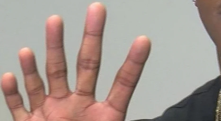 Carolina Panthers Sign Rookie Who Has Six Fingers On One Of His Hands