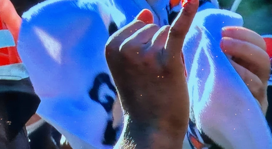 New Close-Up Image Of Shedeur Sanders’ Nasty Busted-Up Finger Will Make Your Stomach Turn [PHOTO]